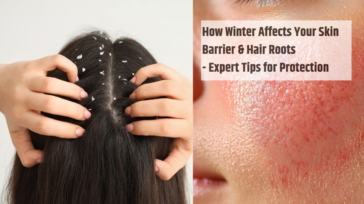 How Winter Affects Your Skin Barrier & Hair Roots - Expert Tips for Protection